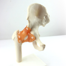 JOINT06 (12353) Medizinische Anatomie natürliche Größe Hip Joint Modelle